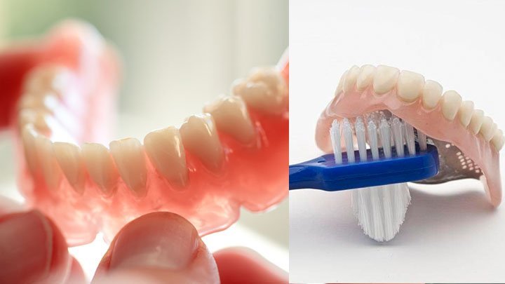 How to Clean Upper and Lower Dentures?